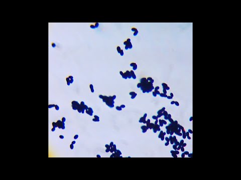 Видео: Malassezia (малассезия) - необычные дрожжи. Посев, микроскопия, идентификация дрожжей Малассезия