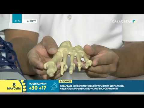 Видео: Жалпақ табандылық. Емдеу және алдын алу