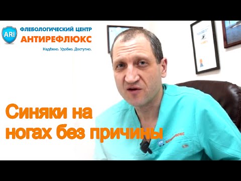 Видео: Синяки на ногах без причины, что это и что делать?