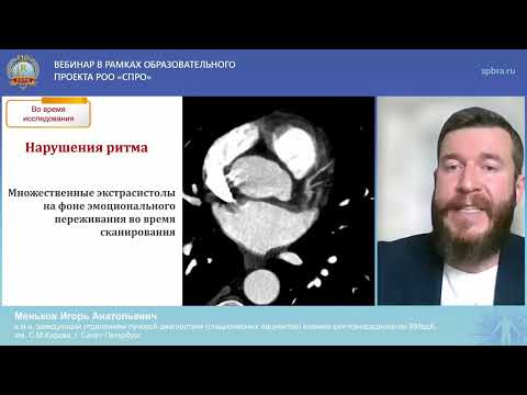 Видео: Вебинар «Трудности диагностики сердца»