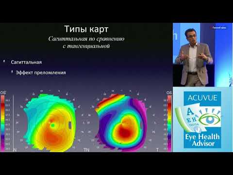 Видео: Клиническое применение данных топографии роговицы