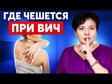 Видео: Опасные признаки! Какой зуд указывает на ИППП и ВИЧ?