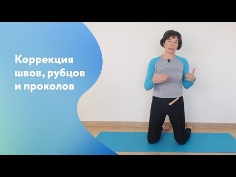 Видео: Удаление шрамов, лечение рубцов