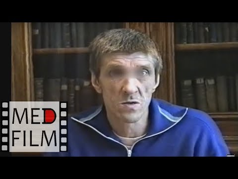 Видео: (R) Шизофрения. Фабула величия. Парафренный синдром © Schizophrenia, paraphrenic syndrome