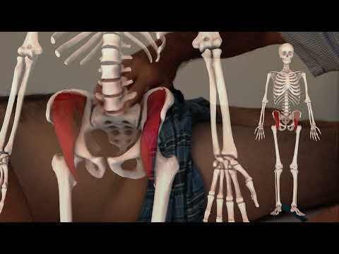 Видео: Лечение триггерных точек поясничной мышцы при болях в пояснице