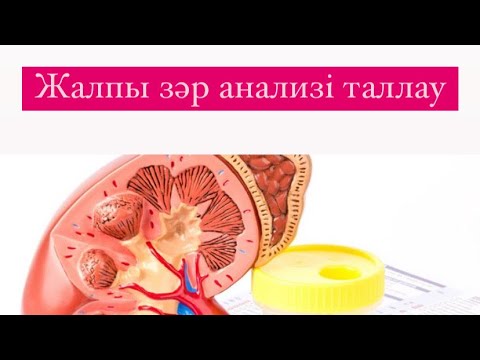 Видео: Жалпы зәр анализін талдау.Нечипоренко және зимницкий сынамасы
