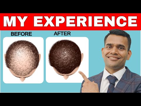 Видео: Как я остановил выпадение волос и эффективные советы по их росту — доктор Вивек Джоши