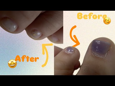 Видео: Переделываю 4-х недельный педикюр с кучами отслоек😵‍💫