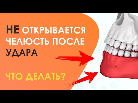 Видео: Челюсть НЕ ОТКРЫВАЕТСЯ после удара: Что делать, Как лечить, Когда пройдет