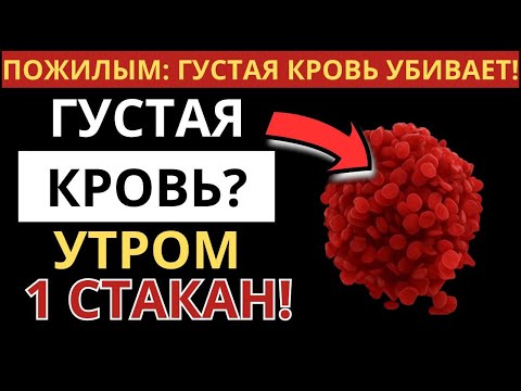Видео: Боишься тромбов после 60? Пей это утром и избегай этих 3 ошибок!