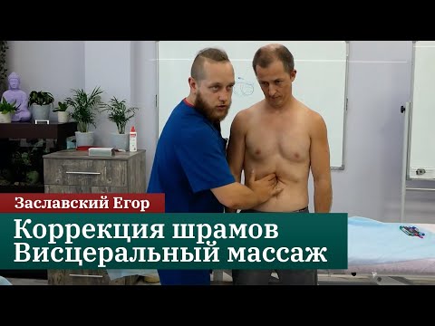 Видео: Коррекция шрамов. Висцеральный массаж. Заславский Егор