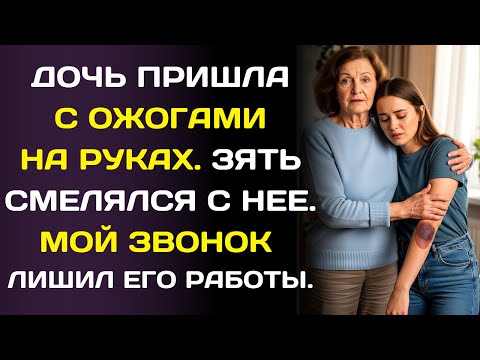 Видео: Дочь пришла с ожогами… а зять усмехнулся: «Я облил её кипятком. И что?»