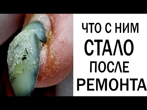 Видео: ОГРОМНАЯ ТРЕЩИНА /// все "плохо"