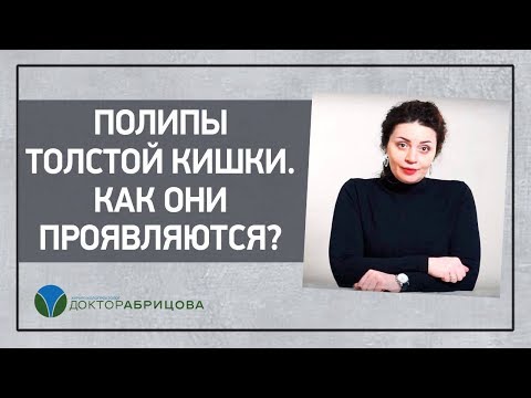 Видео: Полипы толстой кишки.  Как они проявляются?