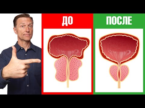 Видео: Увеличенная простата? Лучший нутриент для здоровья простаты!👌