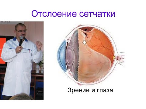Видео: Отслоение сетчатки. Его правильное лечение.