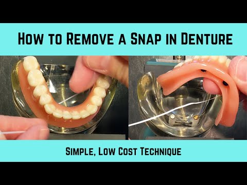 Видео: Простой способ удалить защелку из зубного протеза