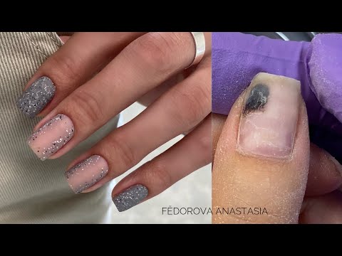 Видео: Травма, четкий квадрат, маникюр самой себе! Работа гелем, акригелем🤗