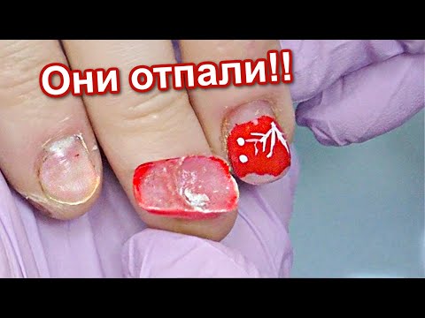 Видео: Отпали Ногти Через 4 дня 😭 Преображение Обгрызенных Ногтей - Беби Бумер и Верхние Формы