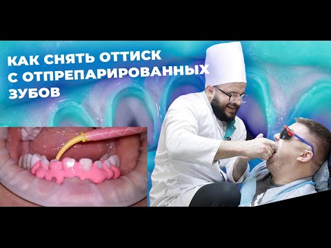Видео: ОРТОПЕДИЧЕСКАЯ СТОМАТОЛОГИЯ КАК СНЯТЬ ОТТИСК