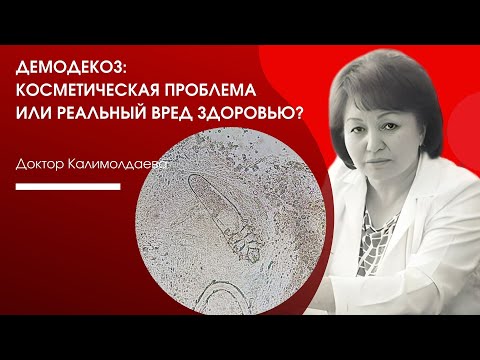 Видео: ДЕМОДЕКОЗ: КОСМЕТИЧЕСКАЯ ПРОБЛЕМА ИЛИ РЕАЛЬНЫЙ ВРЕД ЗДОРОВЬЮ?