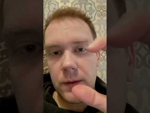 Видео: Онколог моя история с онко и опухолями