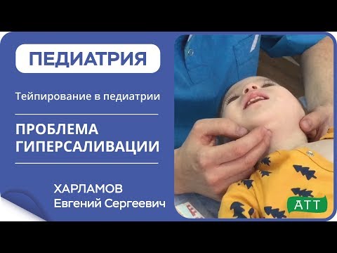 Видео: Проблема гиперсаливация.  Тейпирование в педиатрии