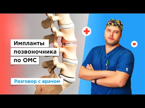 Видео: Установка имплантов позвоночника бесплатно по полису ОМС