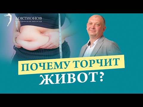 Видео: Как диастаз влияет на выпячивание живота? Основные причины и способы решения