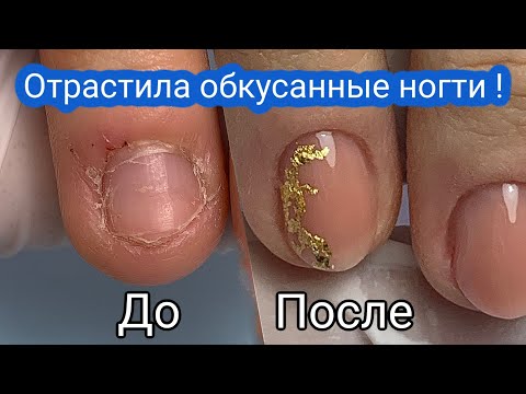 Видео: Как Восстановить Обгрызенные Ногти - Невероятное Преображение Гель - Лаком До и После