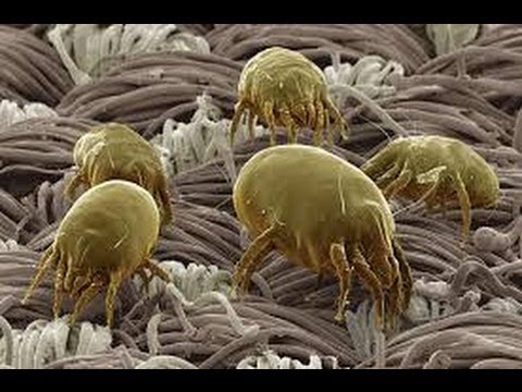 Видео: Ю.Корея 87 Борьба с пылевыми клещами в матрасе