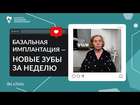 Видео: Базальная имплантация – лечение зубов любой сложности | Отзыв пациента про Центр ИБИ