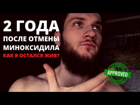 Видео: Миноксидил зло? Реально ли вырастить густую бороду? 2 года после отмены миноксидила. История успеха