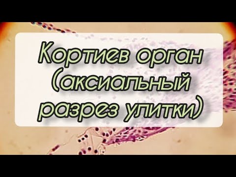 Видео: Кортиев орган (аксиальный разрез улитки)