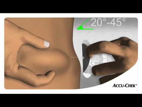 Видео: Инфузионный набор Акку-Чек ТендерЛинк