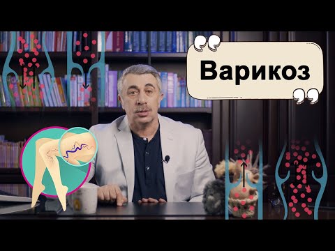 Видео: Варикоз.