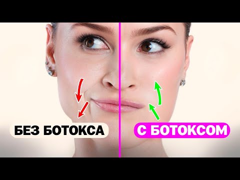 Видео: Как сохранить гладкую кожу без ботокса?