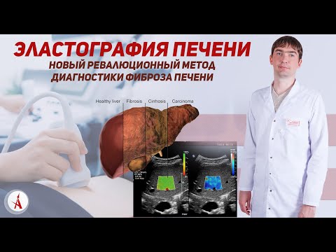Видео: Эластография печени сдвиговой волной. Диагностика фиброза печени.