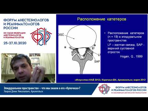 Видео: Эпидуральное пространство - что мы знаем о его «булочках»? Уваров Д. Н.