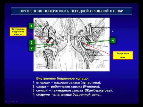 Видео: Оперативная хирургия 3.Бедренные грыжи. Аппендэктомия