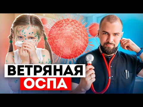 Видео: Чем опасна ветряная оспа?