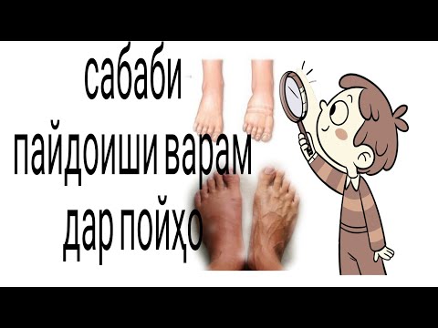 Видео: ХАТМАН ТАМОШО КУНЕД // НОРАСОИИ КОРИ ДИЛ ВА ГУРДА//ВАРИКОЗ