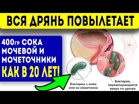 Видео: 2 стак. ЭТОГО СОКА ВЫГОНИТ из мочевого пузыря, мочеточников и почек всю гадость! Народная медицина!