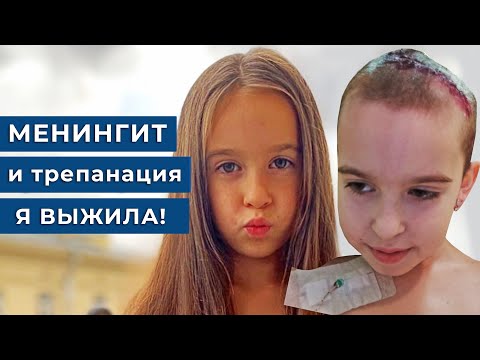 Видео: Менингит привёл к трепанации черепа / Менингит у детей, Альбина 9 лет
