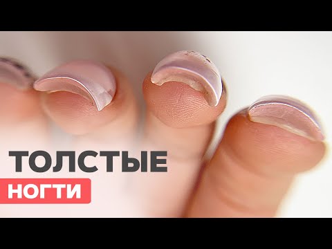 Видео: ТОЛСТЫЕ НОГТИ | Ошибки наращивания верхними формами