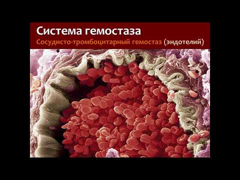 Видео: Физиология гемостаза; Синдром диссеминированного внутрисосудистого свёртывания.