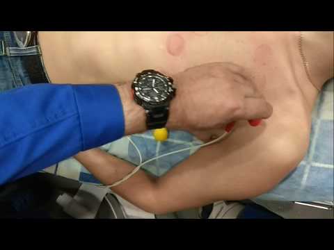 Видео: ЭКГ ПО СЛОПАКУ