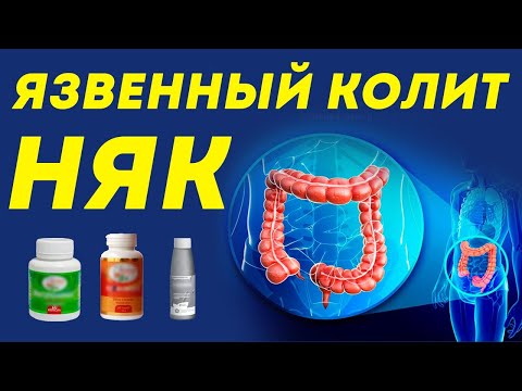 Видео: Почему болит кишечник? Болезнь КРОНА и язвенный колит (НЯК)