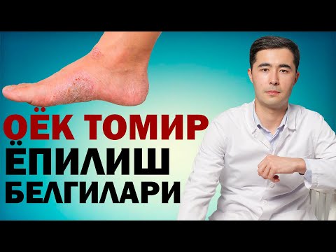 Видео: ОЁК ТОМИРЛАРИ ЁПИЛИШ БЕЛГИЛАРИ. КЕЧ БУЛМАЙ БИЛИБ ОЛИНГ
