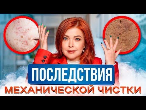Видео: ГЛУБОКАЯ ЧИСТКА ЛИЦА может УГРОБИТЬ вашу кожу? / ВСЯ ПРАВДА о механической чистке лица